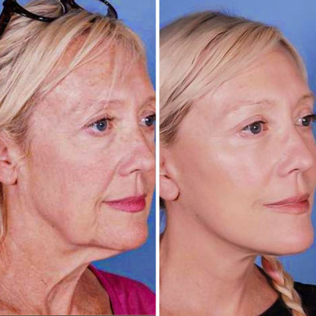 Facial Massage Device