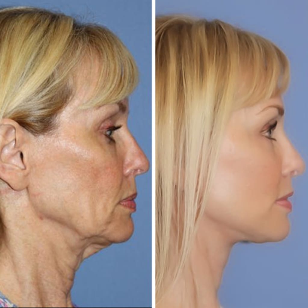 Facial Massage Device