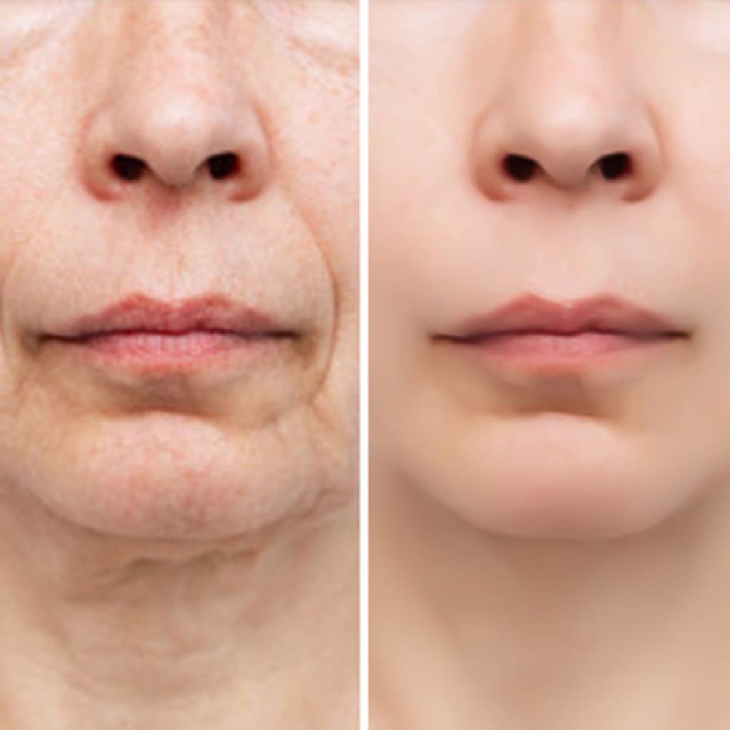 Facial Massage Device